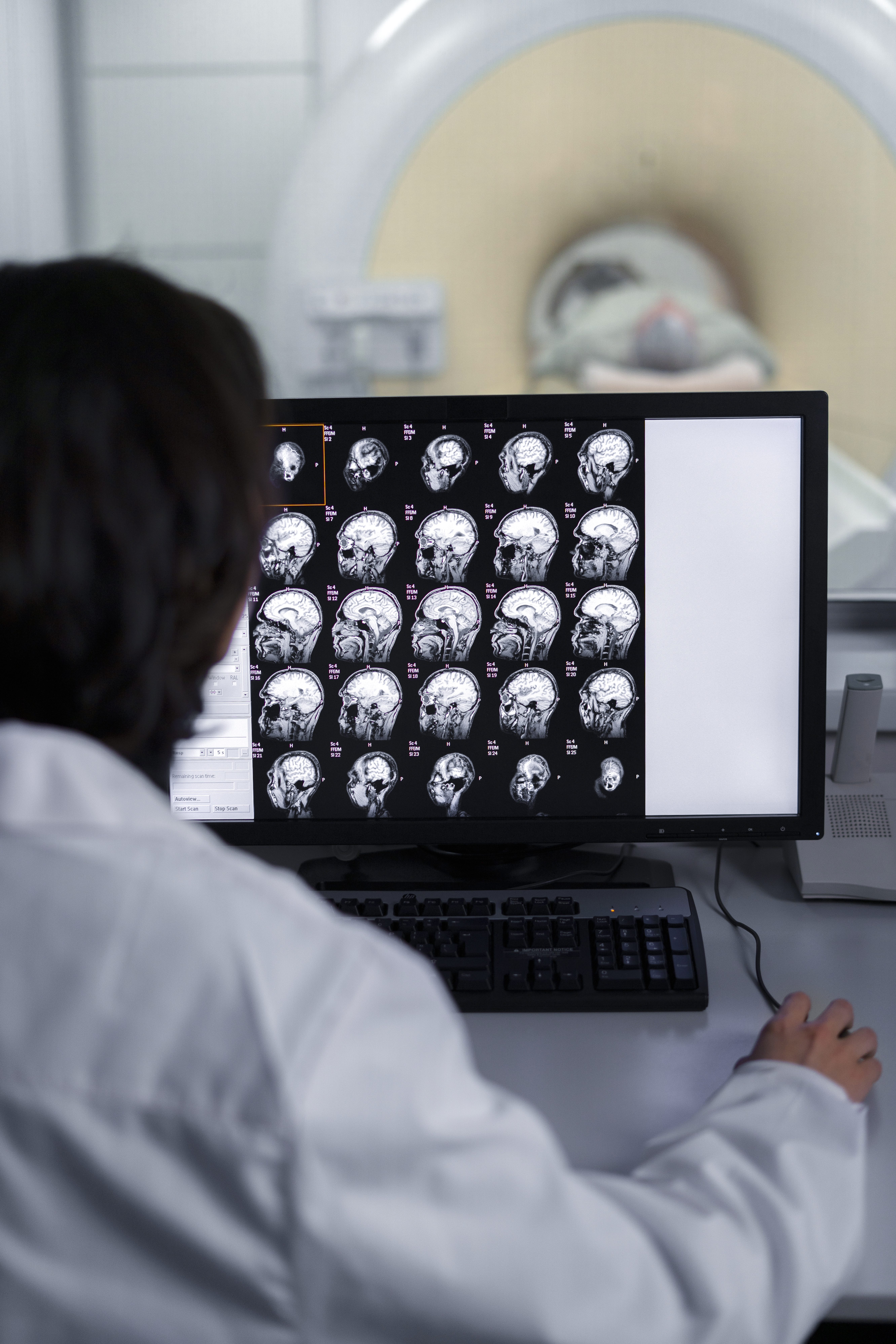 CT Scan en Pickens Decatur